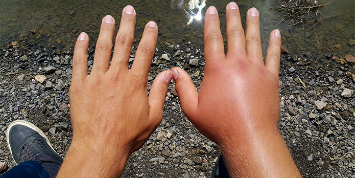 complex regional pain syndrome treatment and chiropractic conditions in Irvine