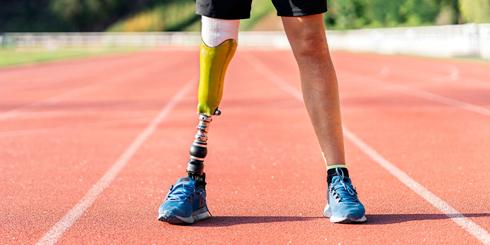 phantom limb syndrome treatment and chiropractic conditions in Irvine