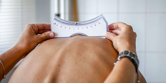 scoliosis treatment and chiropractic conditions in Irvine