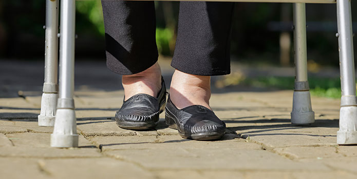 diabetic neuropathy treatment and chiropractic conditions in Irvine