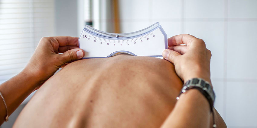 patient needing scoliosis chiropractor in Irvine